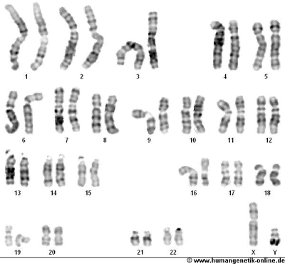 23 Chromosomen-Paare