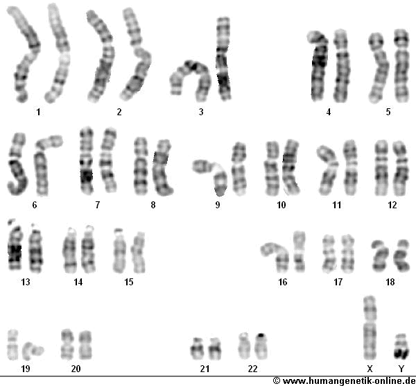 23 Chromosomen-Paare